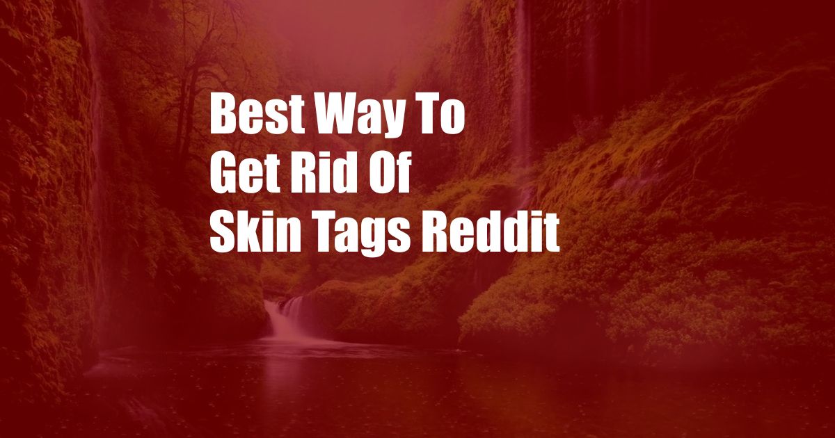 Best Way To Get Rid Of Skin Tags Reddit