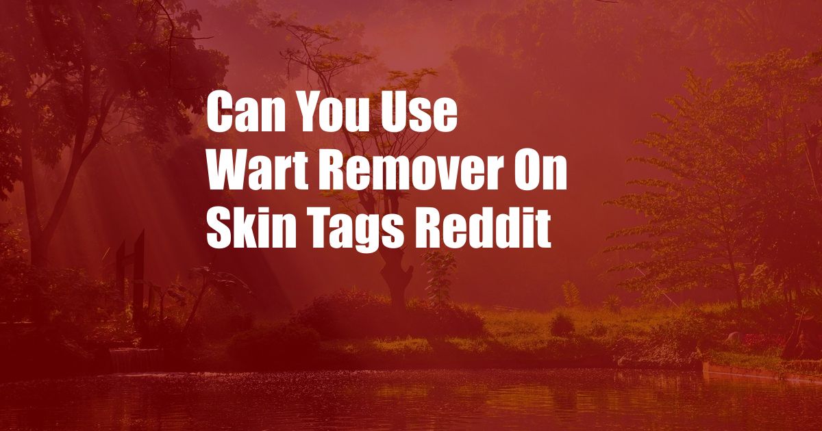 Can You Use Wart Remover On Skin Tags Reddit