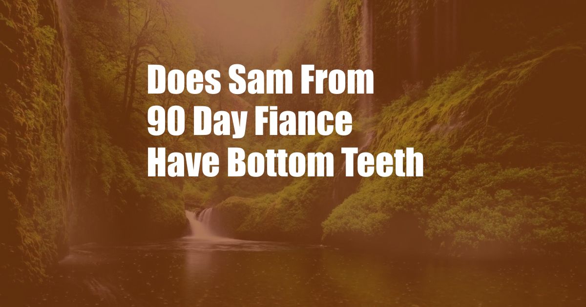 Does Sam From 90 Day Fiance Have Bottom Teeth