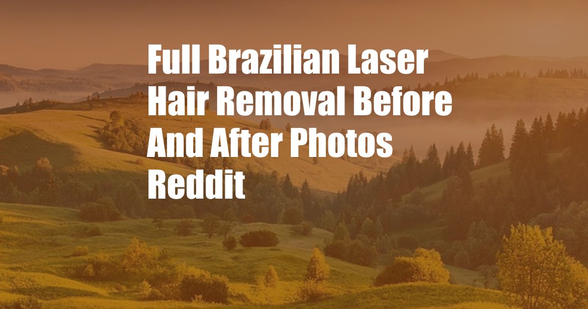Full Brazilian Laser Hair Removal Before And After Photos Reddit