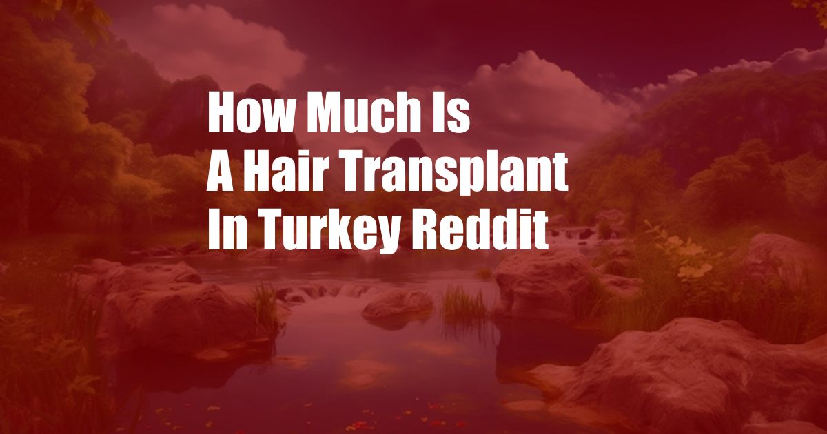 How Much Is A Hair Transplant In Turkey Reddit