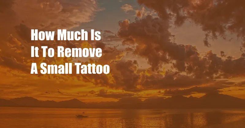 How Much Is It To Remove A Small Tattoo