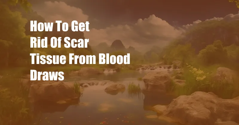 How To Get Rid Of Scar Tissue From Blood Draws