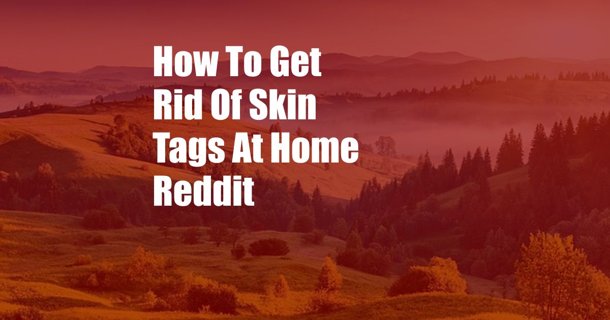 How To Get Rid Of Skin Tags At Home Reddit