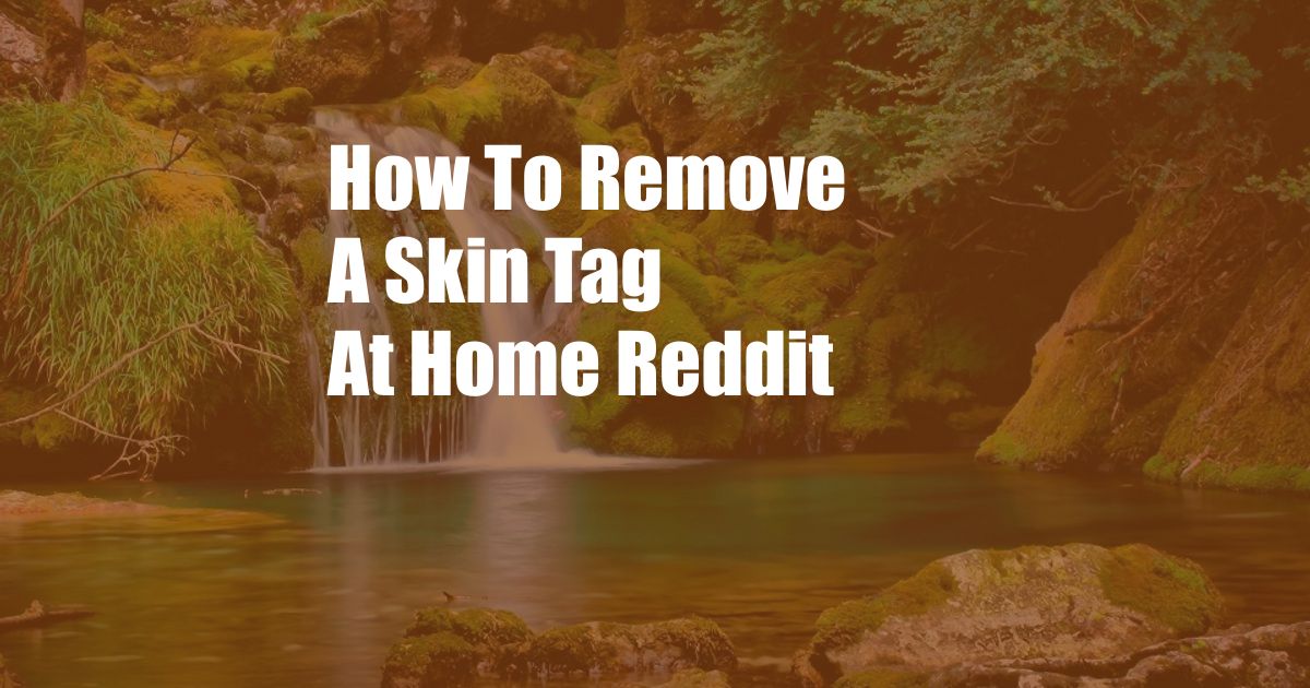 How To Remove A Skin Tag At Home Reddit