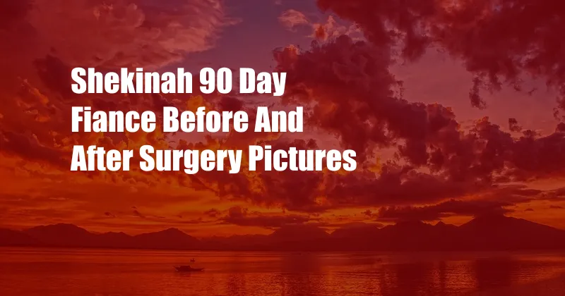 Shekinah 90 Day Fiance Before And After Surgery Pictures