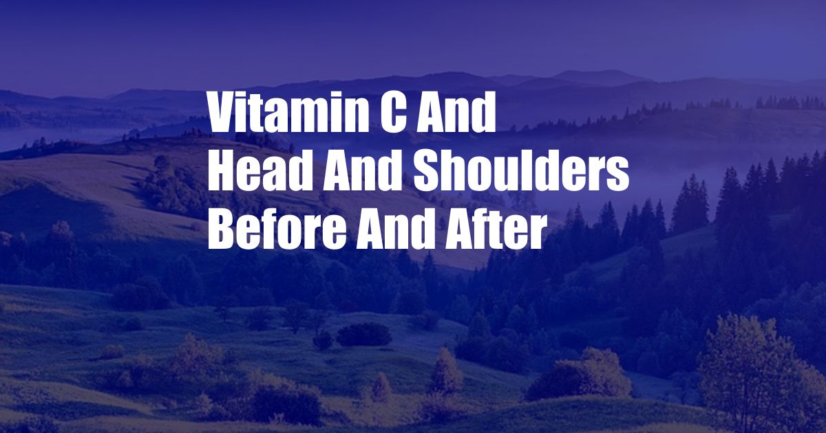 Vitamin C And Head And Shoulders Before And After