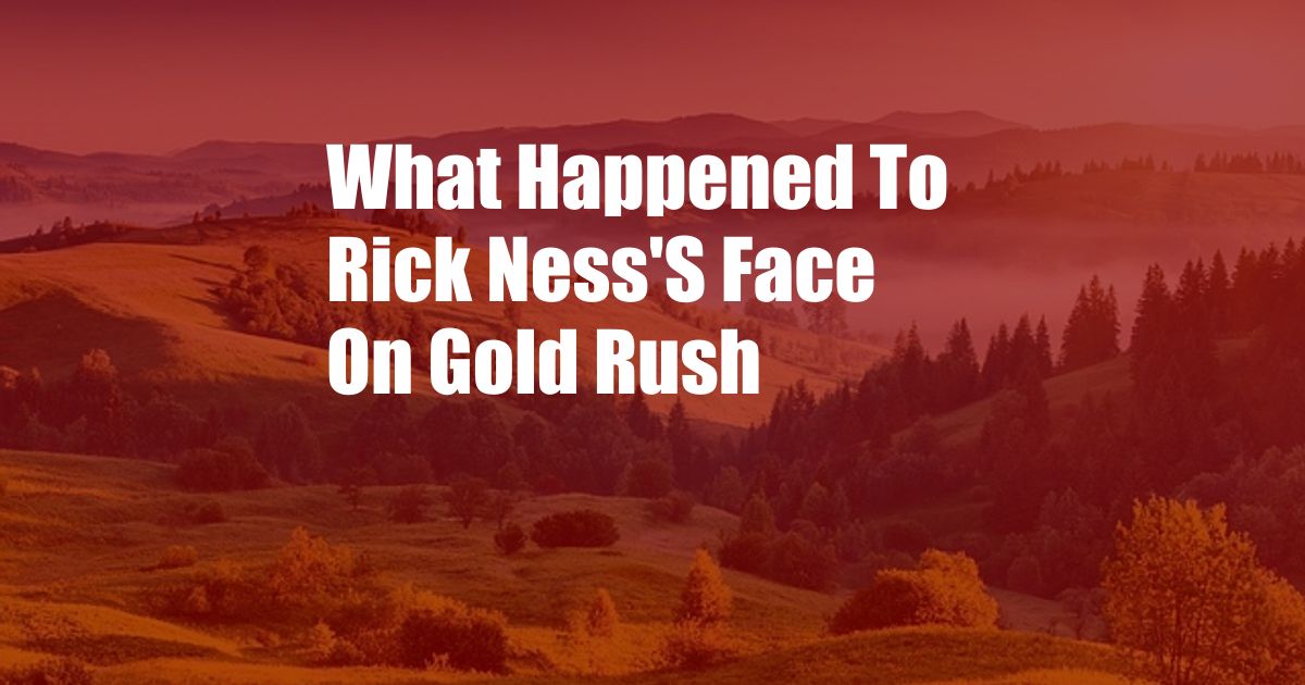 What Happened To Rick Ness'S Face On Gold Rush